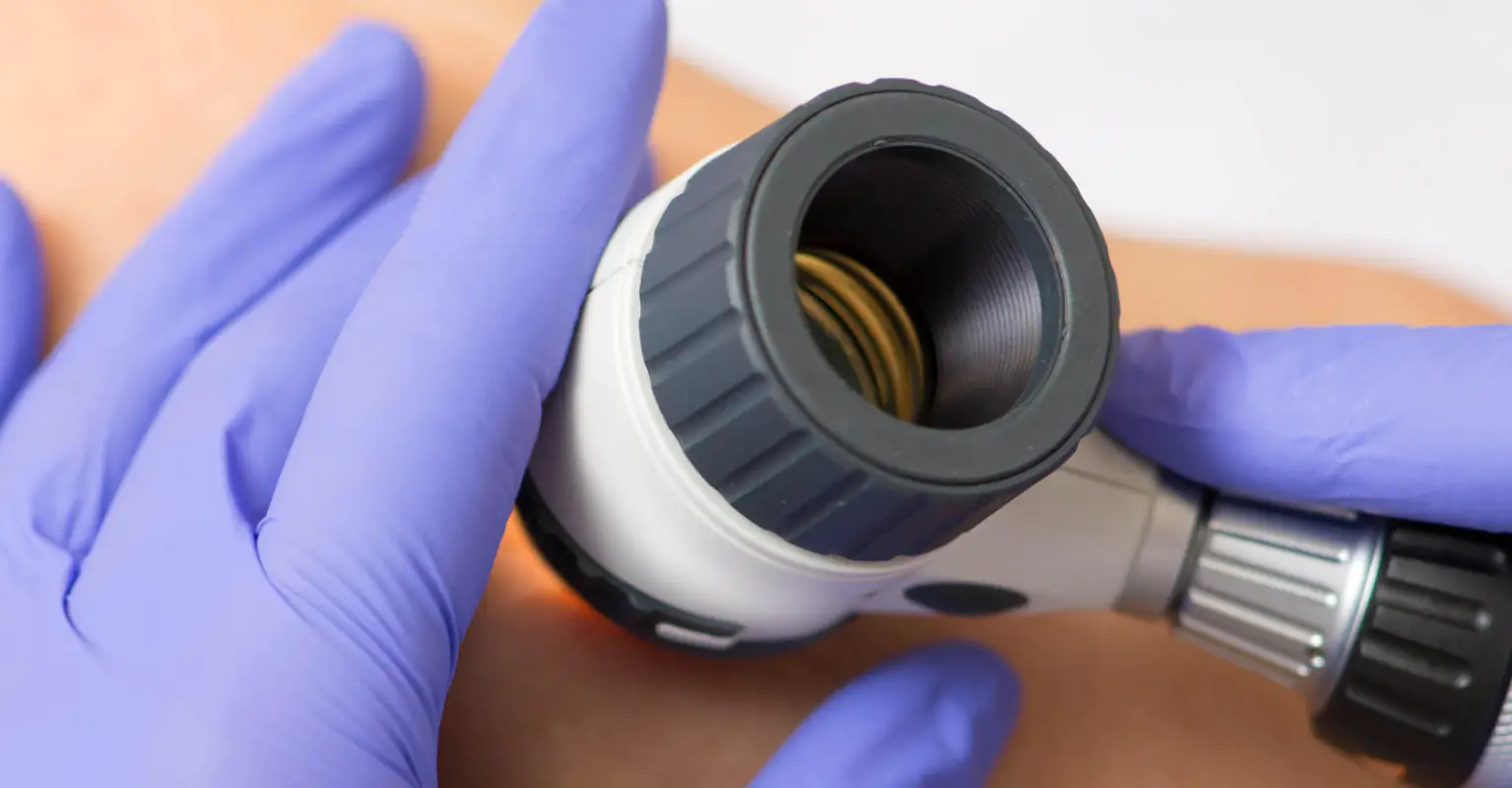 Man given 6 months to live after hairdresser urged him to get suspicious mole checked out