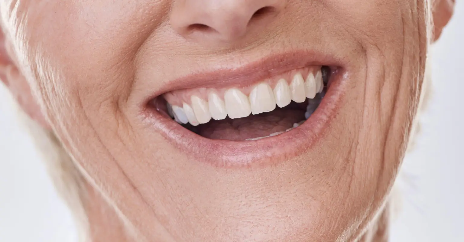 Woman goes viral after showing off veneers she says left her looking like a 'horse'