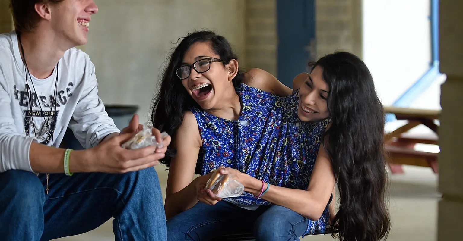 Conjoined twins reveal one of them is asexual, while the other has a boyfriend