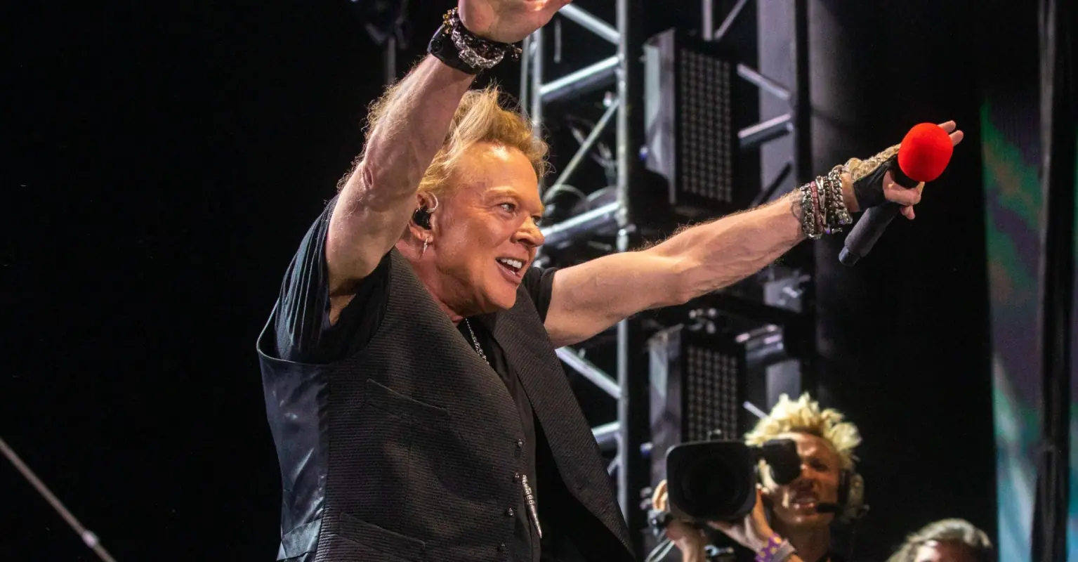 Woman suffers nasty facial injuries after being hit with mic by Axl Rose at Gun N' Roses concert