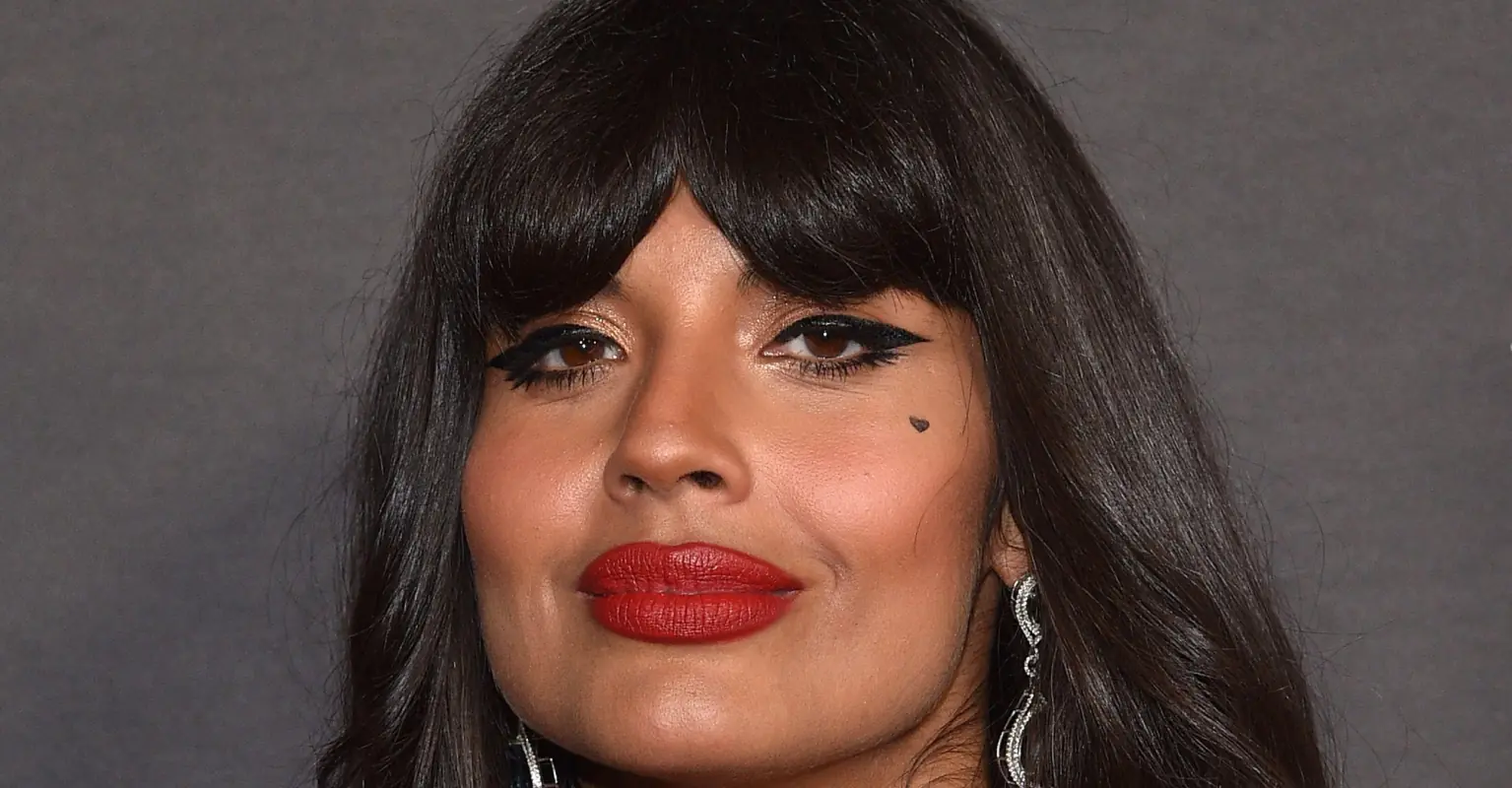 Jameela Jamil shows off 'elastic' skin after being diagnosed with rare condition