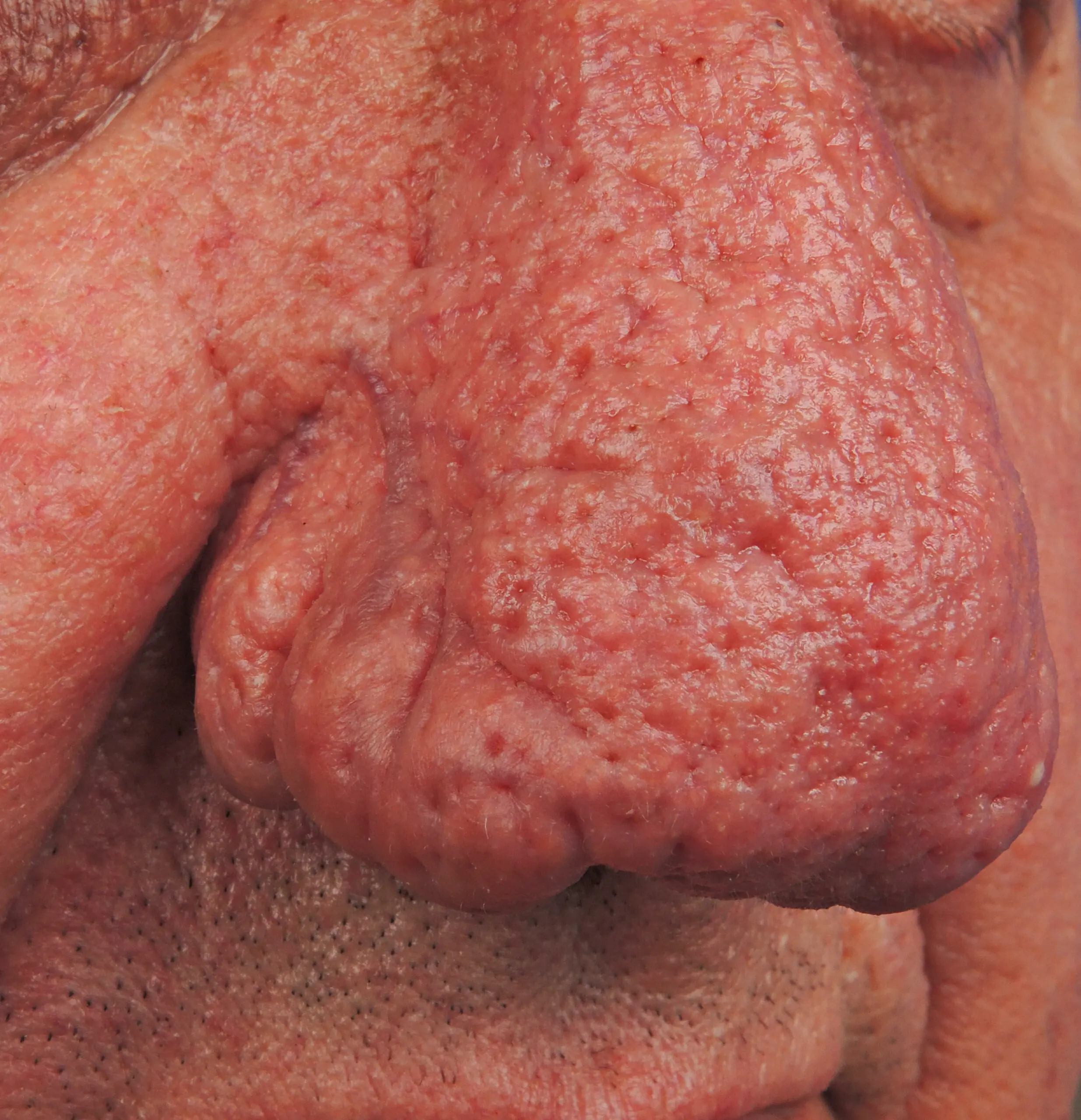 size-full wp-image-1263193679