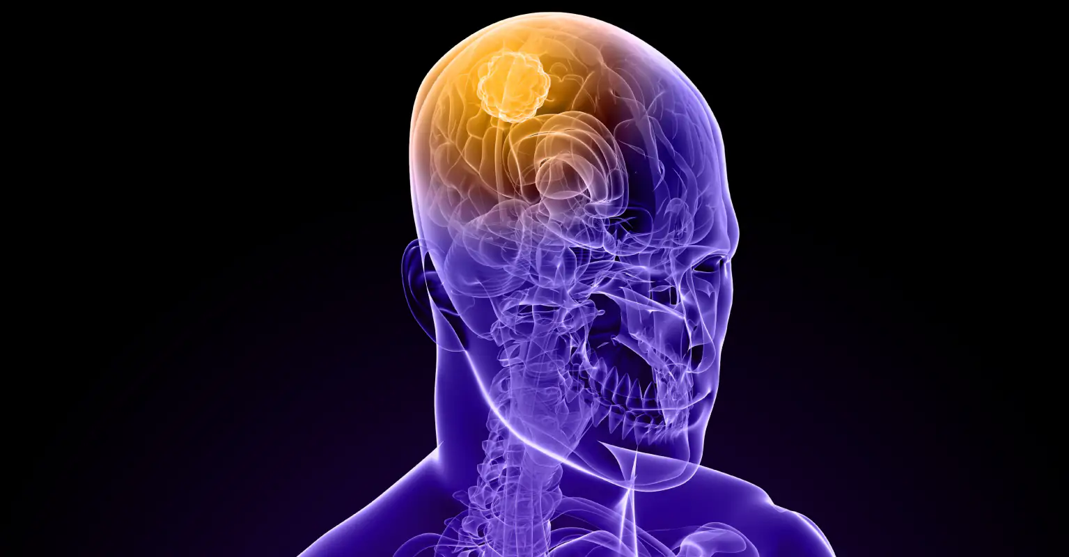 Actress attacked by stranger, gets diagnosed with brain tumor, and is run over by car