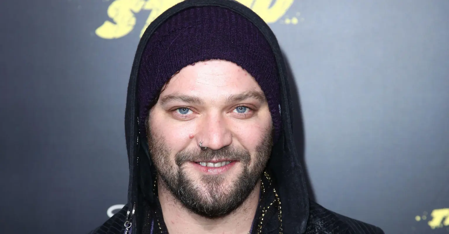Bam Margera shows off results of new face tattoo