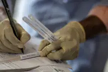 DNA test