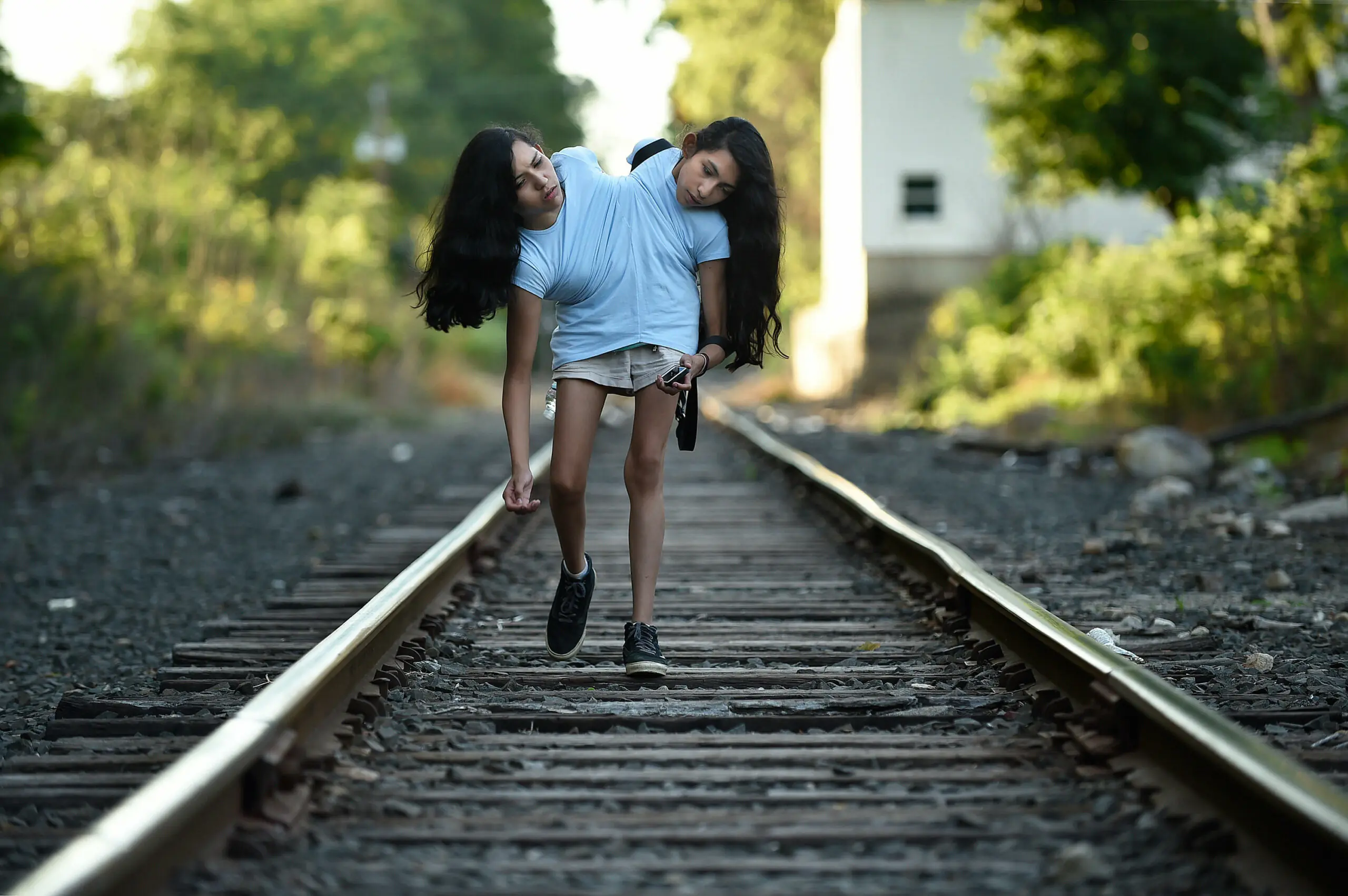 Conjoined twins explain how they make intimacy work as one twin has a boyfriend and one is asexual - Article Image 1