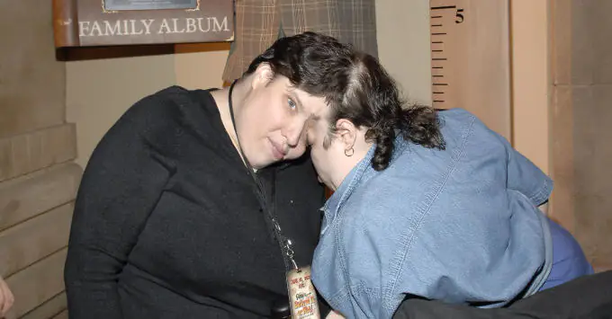 Conjoined twin explains how she and her brother make intimacy work with her boyfriends