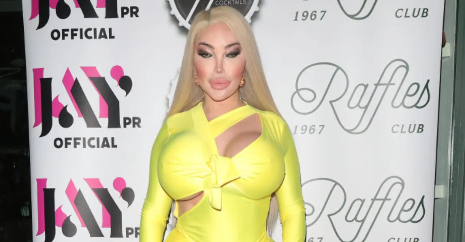 TV star Jessica Alves shows off results of $1 million surgeries