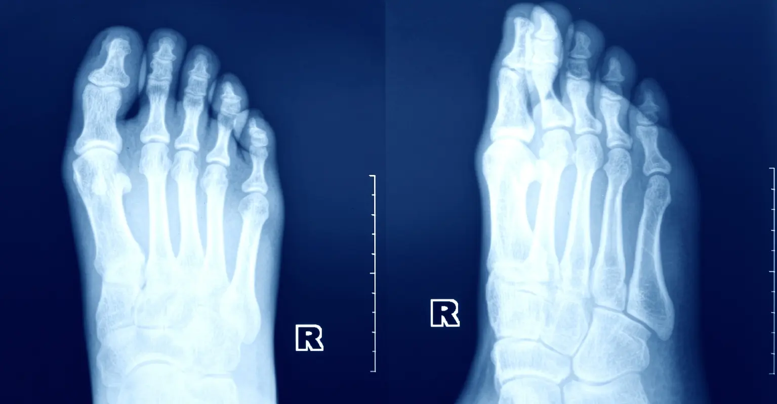 wp-image-1263223754 size-full