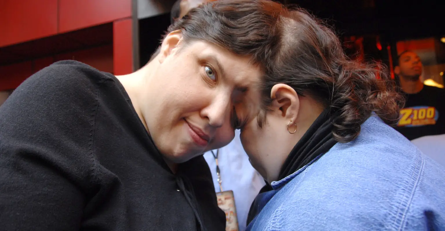 Conjoined twin confesses he hid his true gender from his sister for 46 years