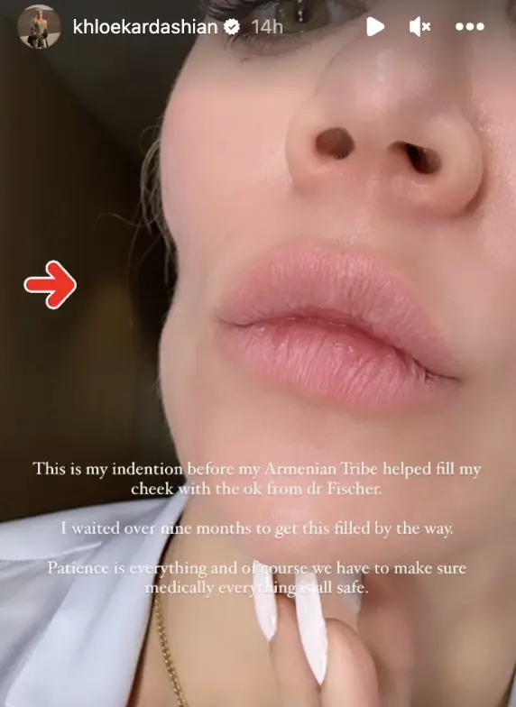 wp-image-1263229380 size-full