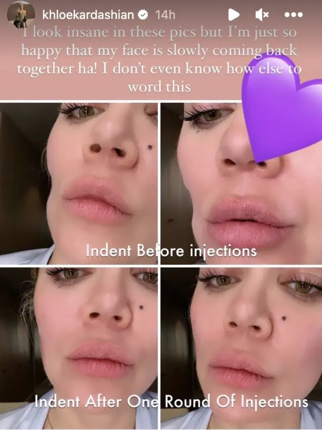 wp-image-1263229383 size-full