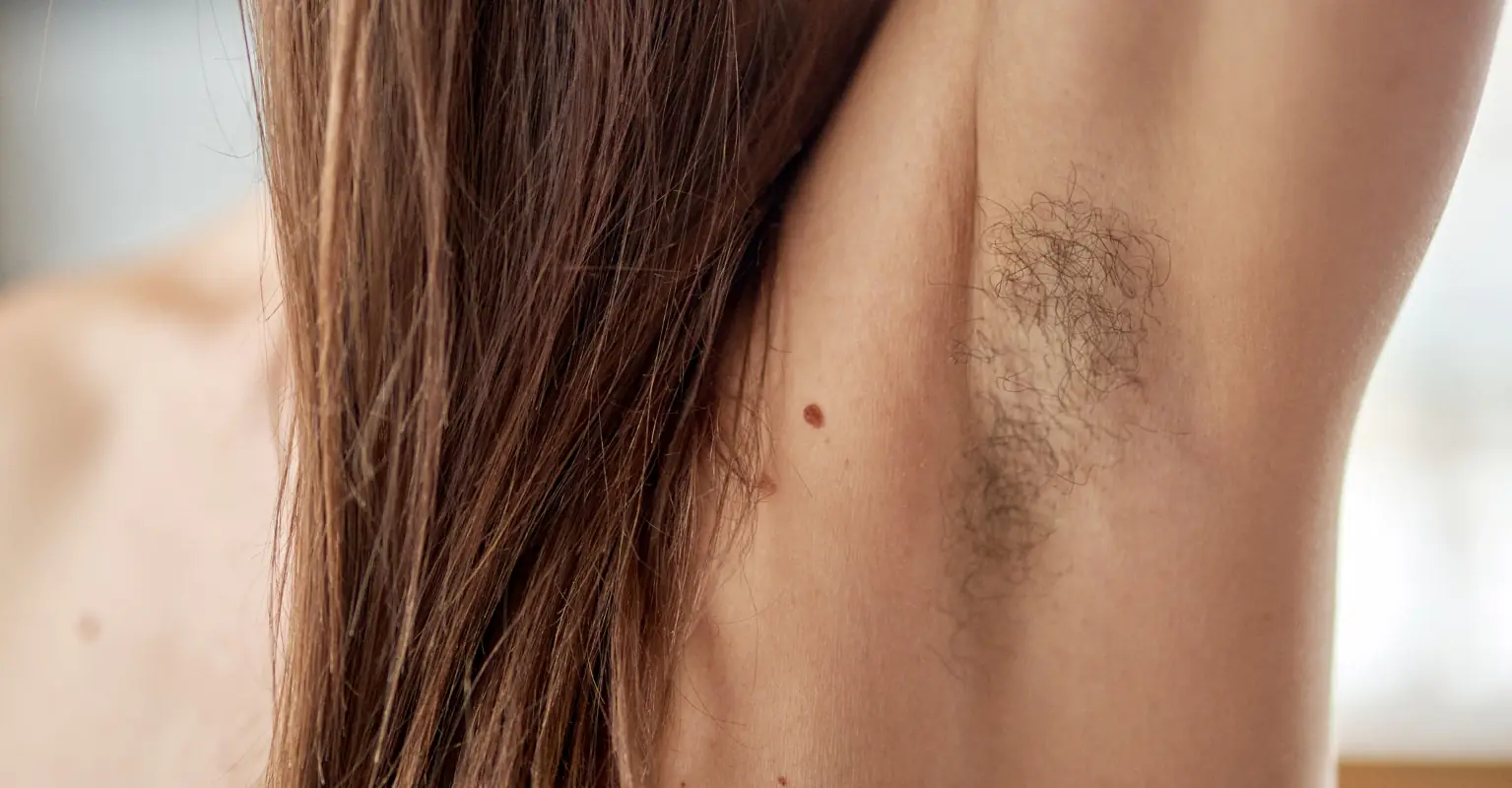 Woman who makes $10,000 a month posting pics of her armpit hair reveals she now has PTSD