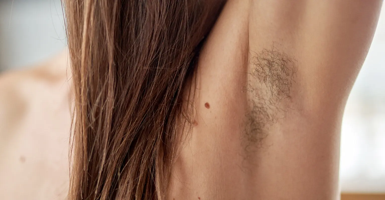 Woman who makes $10,000 a month posting pics of her armpit hair reveals she now has PTSD