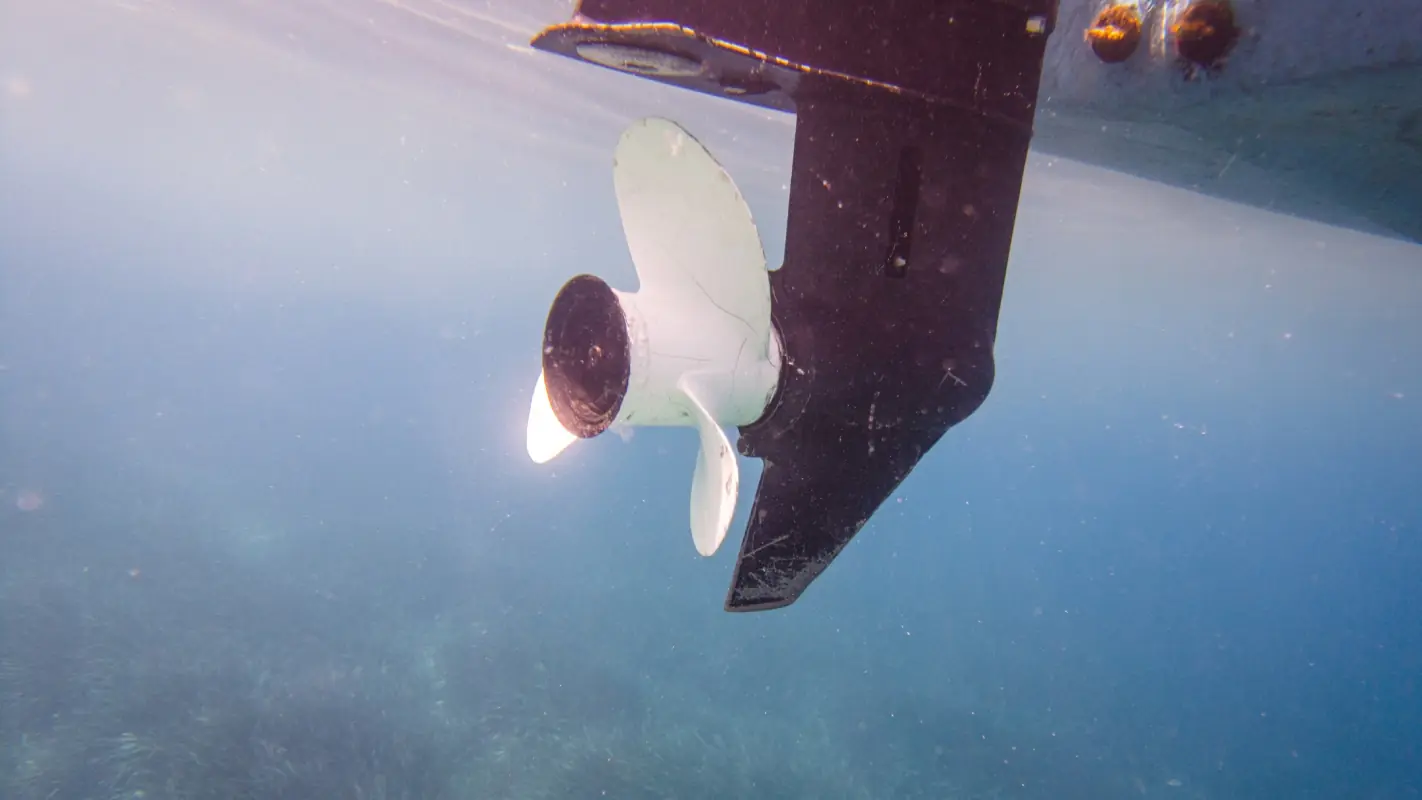 Woman whose butt was 'chopped off' by boat propeller opens up about devastating injuries