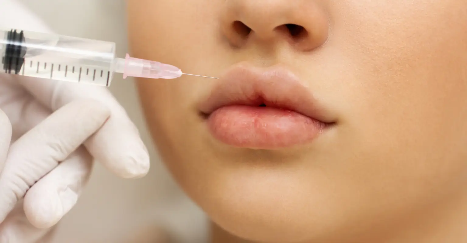 Woman with 30ml lip filler admits she finds it difficult to eat and drink