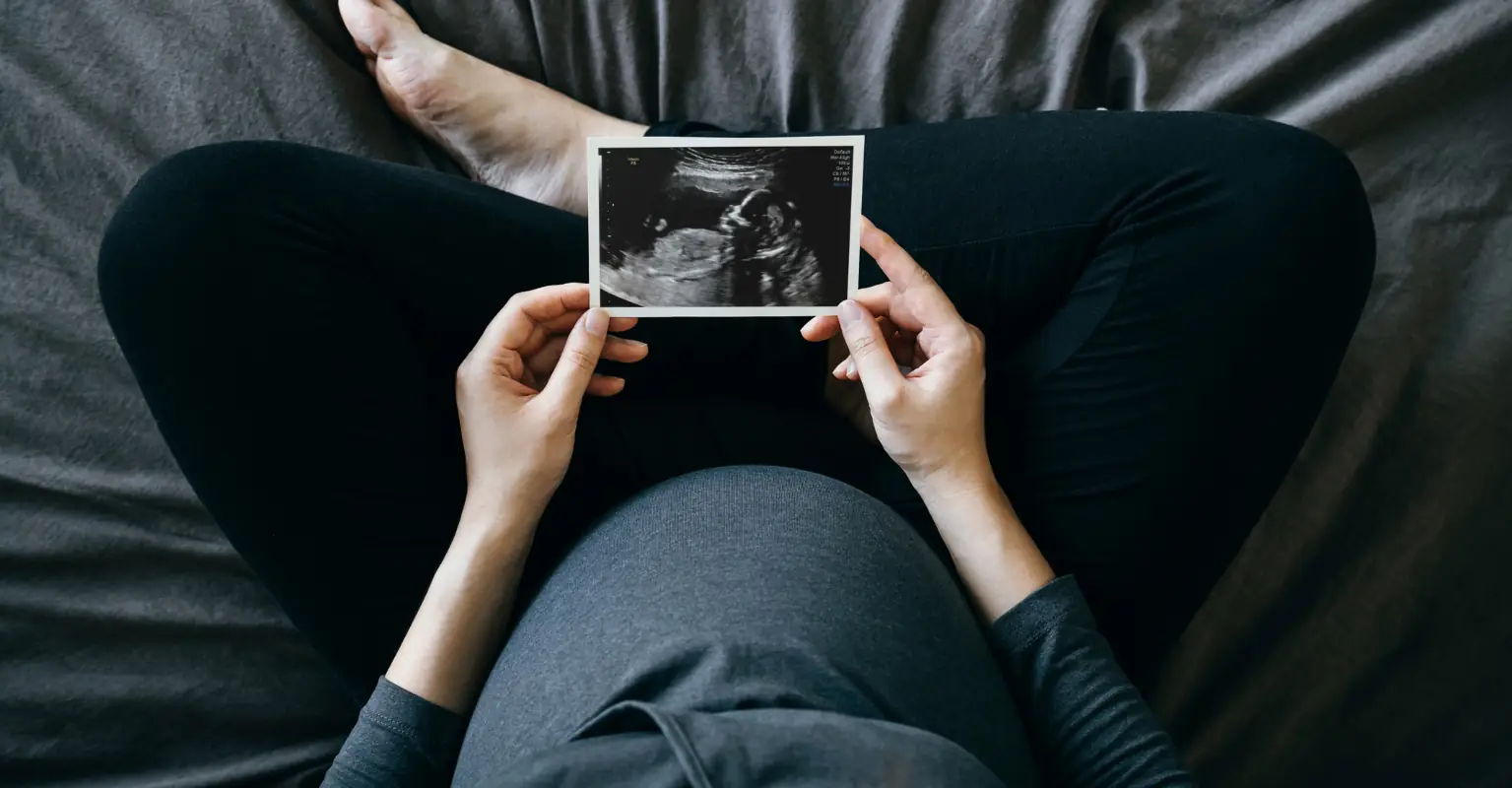 Woman with double uterus learns she's pregnant in each one