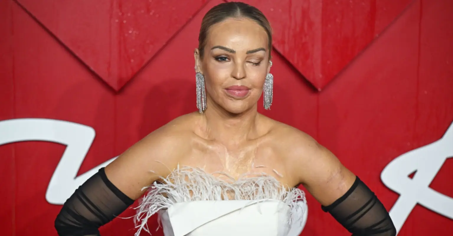 Woman reveals why she had her eye sewn shut after traumatic 2008 incident