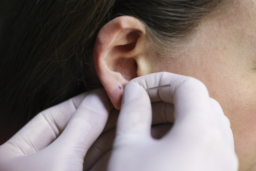 Ear piercing