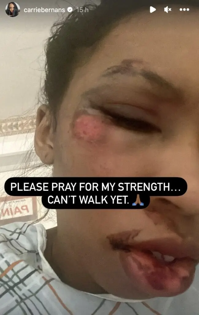 size-large wp-image-1263242418