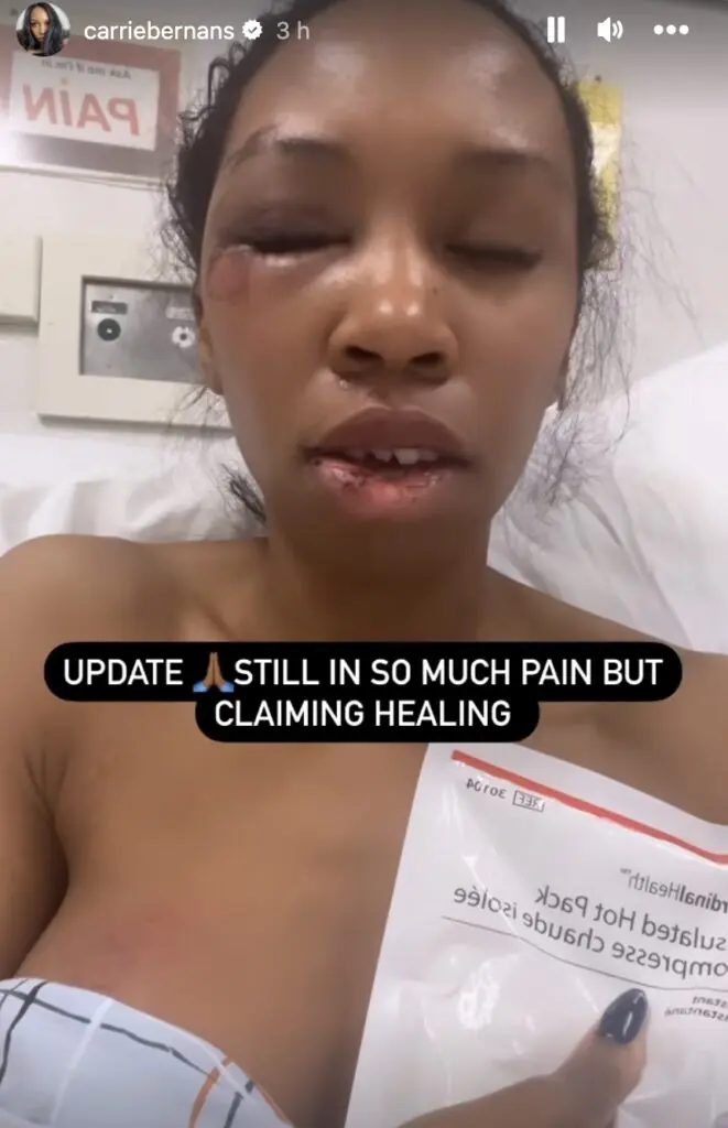 size-large wp-image-1263242417