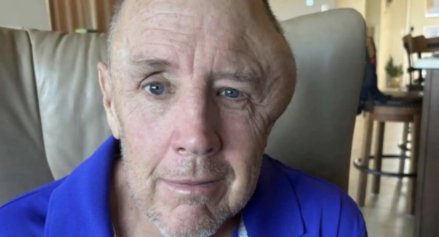 US man issued fine while fighting for his life in coma after being knocked down by e-bike