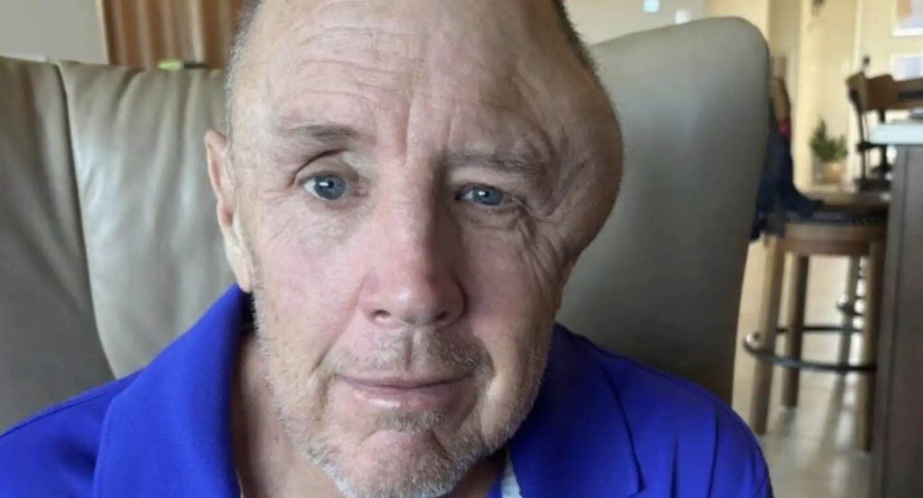 US man issued fine while fighting for his life in coma after being knocked down by e-bike