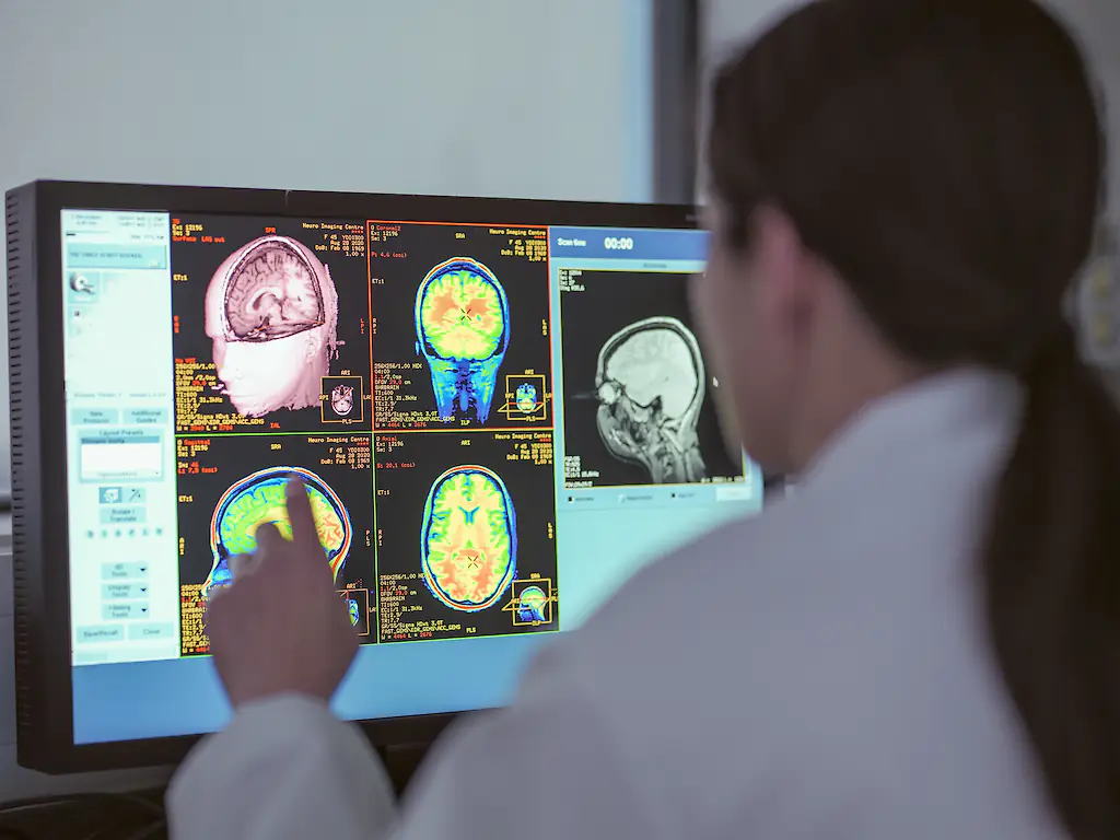 brain scan