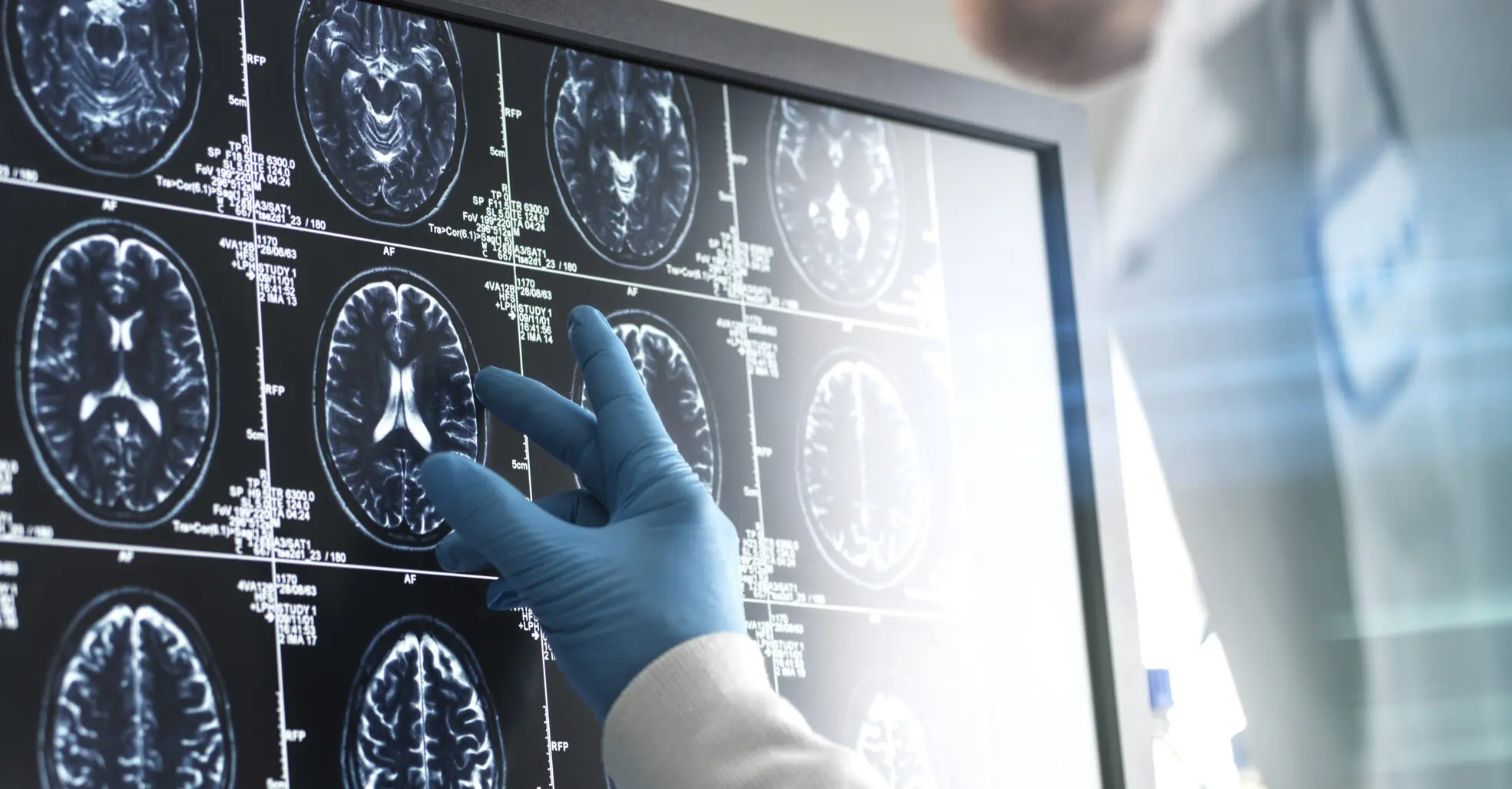 Woman's brain tumor 'almost disappears' just a week in to 'revolutionary' new treatment