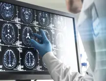 brain scan 