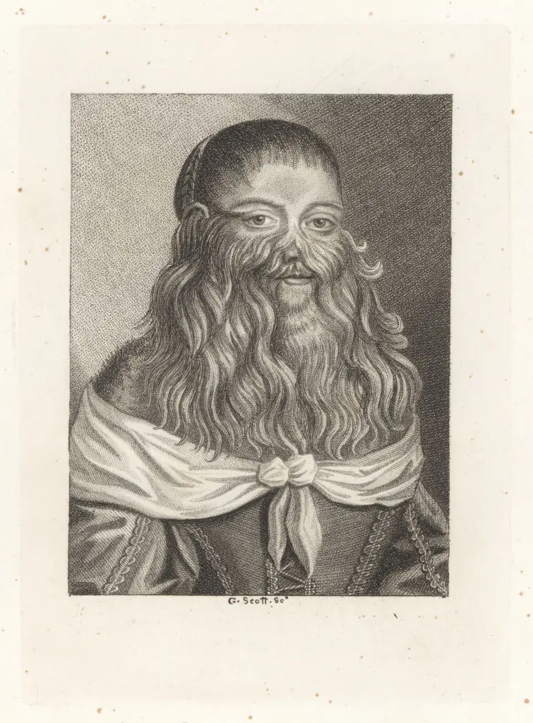 ‘World’s hairiest girl’ now shaves her face as she introduces new partner - Article Image 1