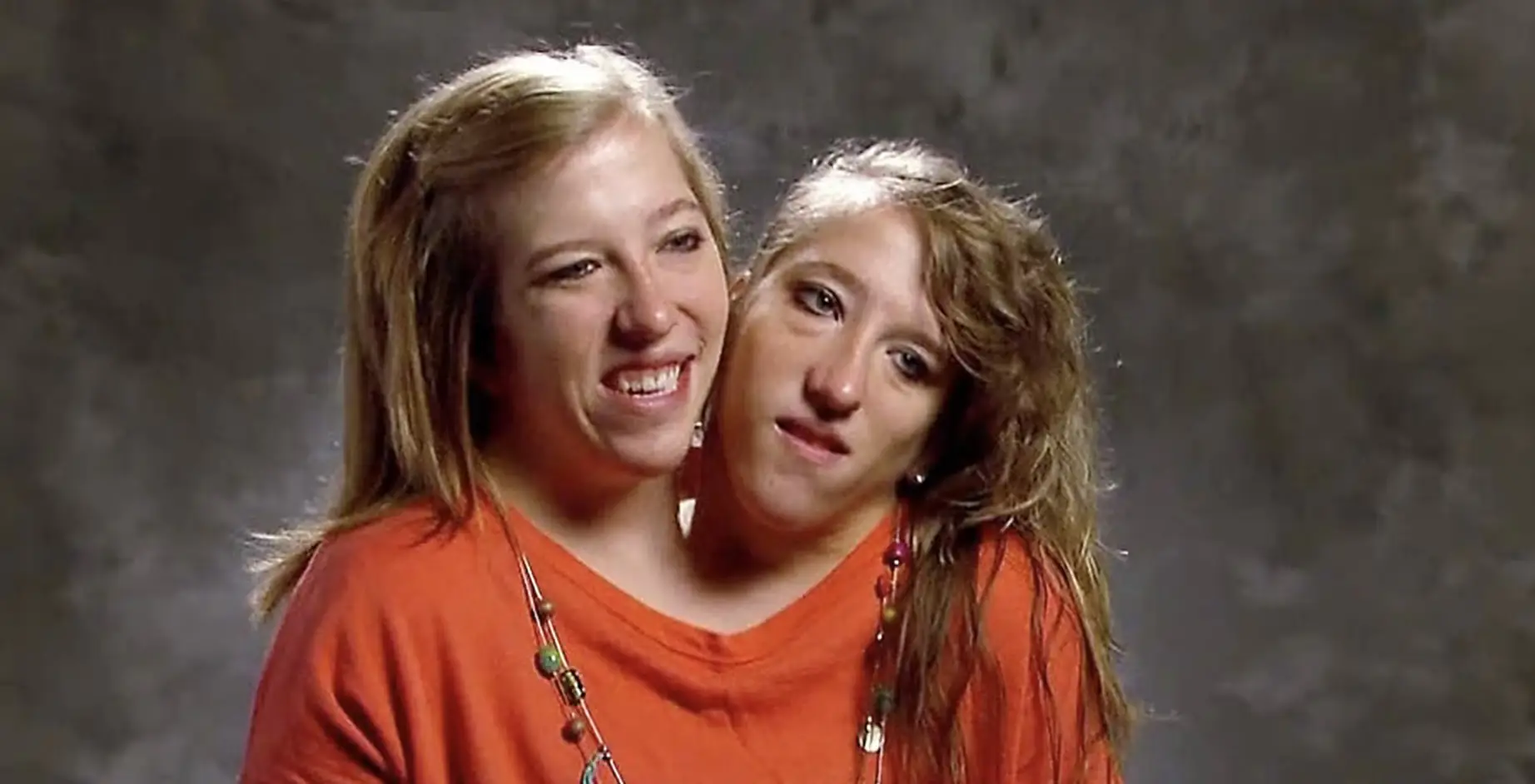 Conjoined twins Abby and Brittany Hensel reveal how they drive a car