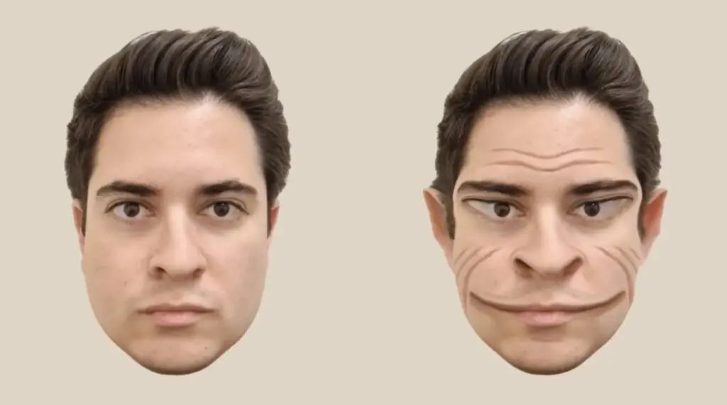 Man's terrifying rare condition makes people's faces look like 'demons' - Article Image 2