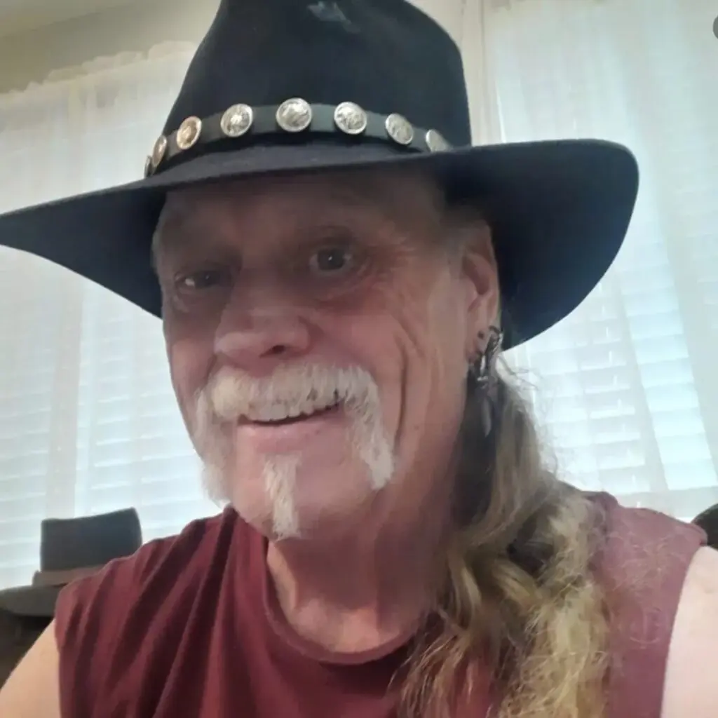 Man's terrifying rare condition makes people's faces look like 'demons' - Article Image 1