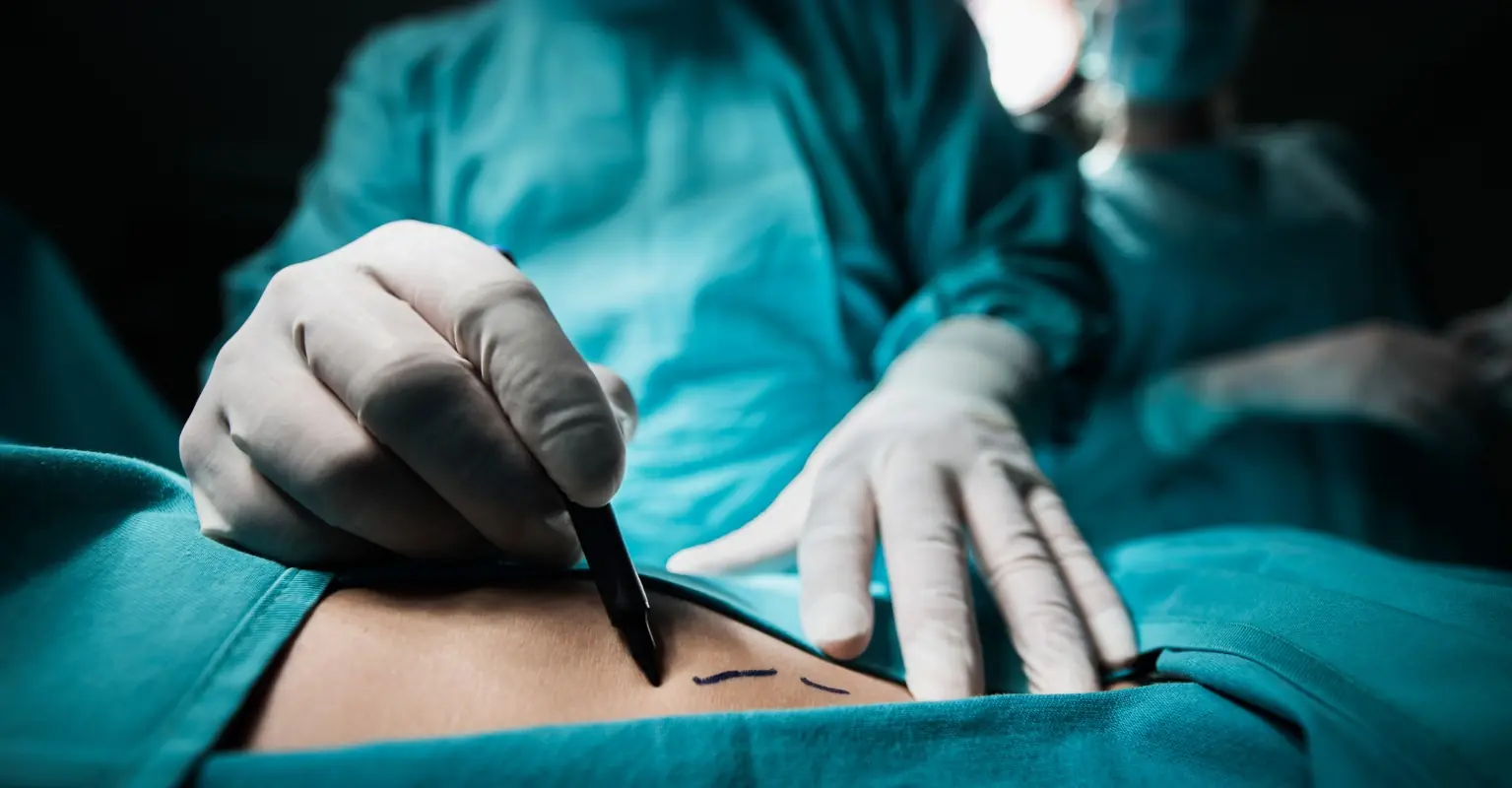 Woman dies following botched 'boob job' - doctor reportedly informed her friends via Instagram message