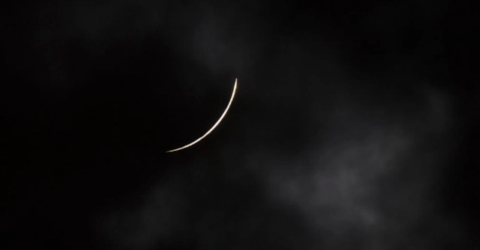 How to tell if your eyes were damaged from Monday's solar eclipse