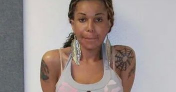 Fake doctor injected patients with tire sealant and cement to give them BBLs, leaving one dead