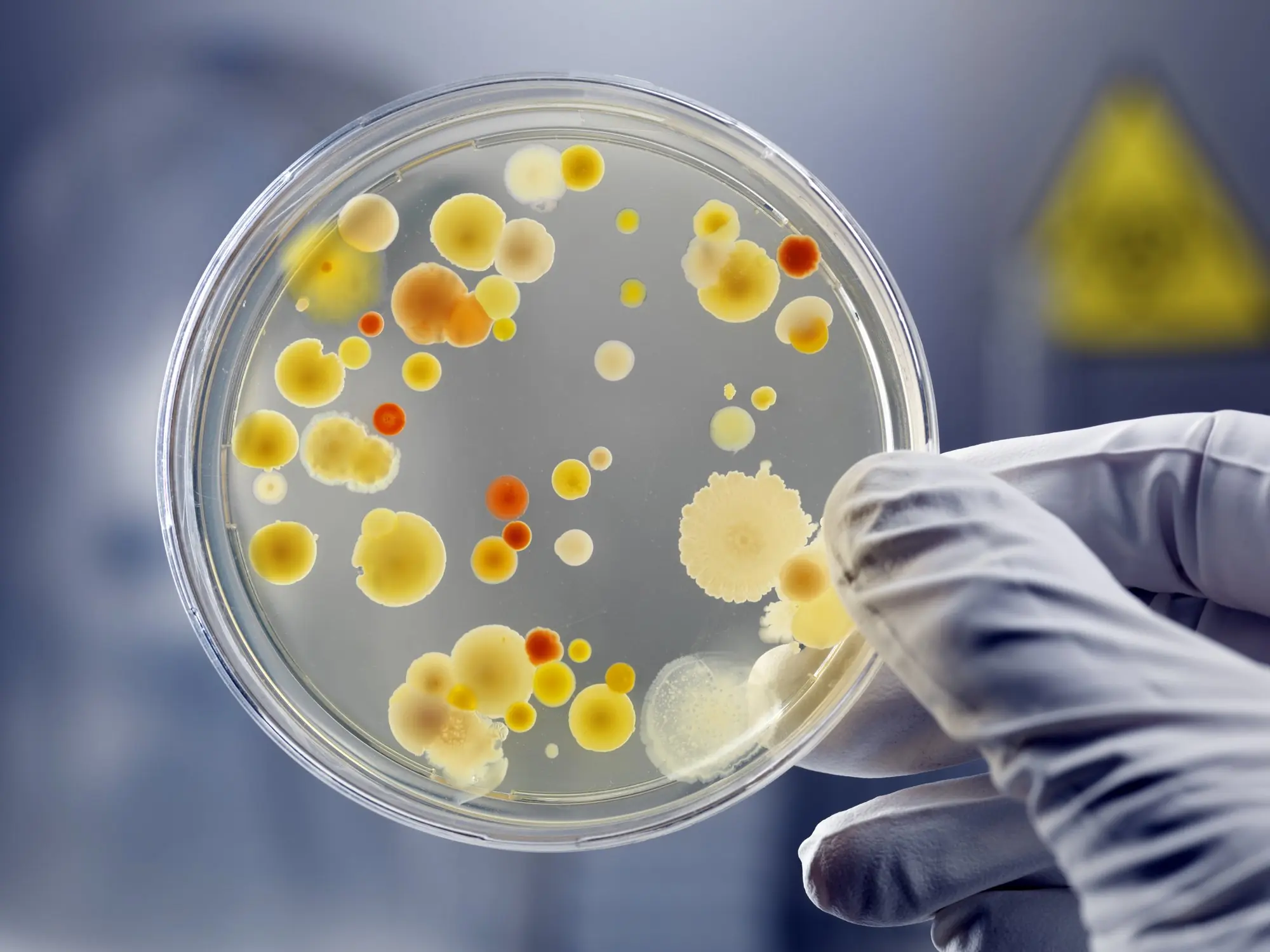 The bacteria is closely related to a bacteria found in soil, sewage, food and human stool. Credit: AndreasReh / Getty