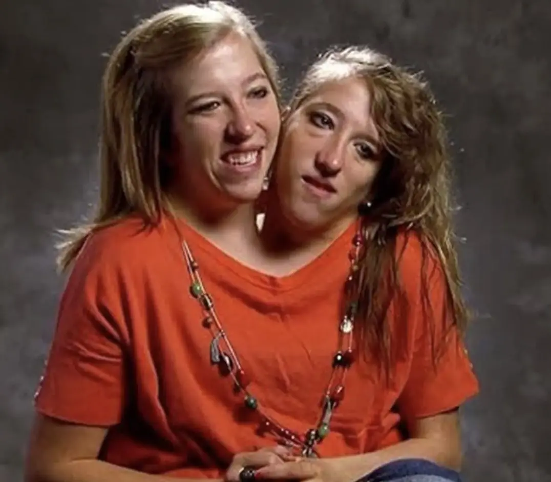 Abby and Brittany are open to having kids. Credit: TLC