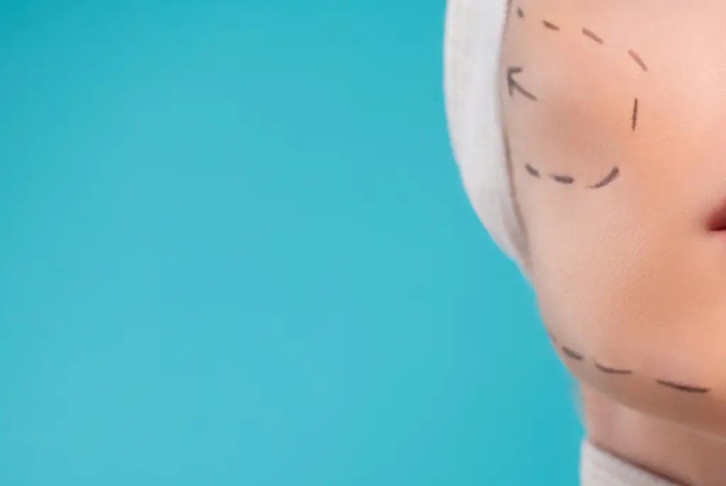 Woman with 'world's biggest cheeks' shares photo of what she looked like before drastic cosmetic work