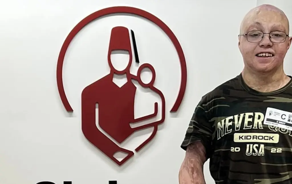 Two-year-old given a '0% chance of survival' after receiving burns to 98% of his body is now inspiring others