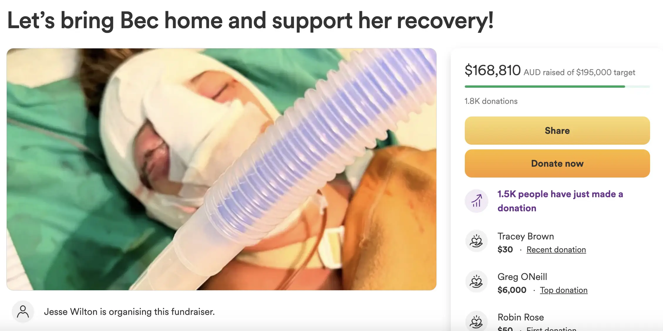 $100,000 raised for woman after mysterious accident leaves her with horrific facial injuries: 'No one knows what happened to her'