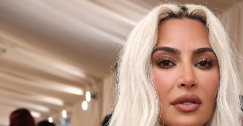 Kim Kardashian reveals stomach-churning injury that left her 'bone sticking out' of her finger