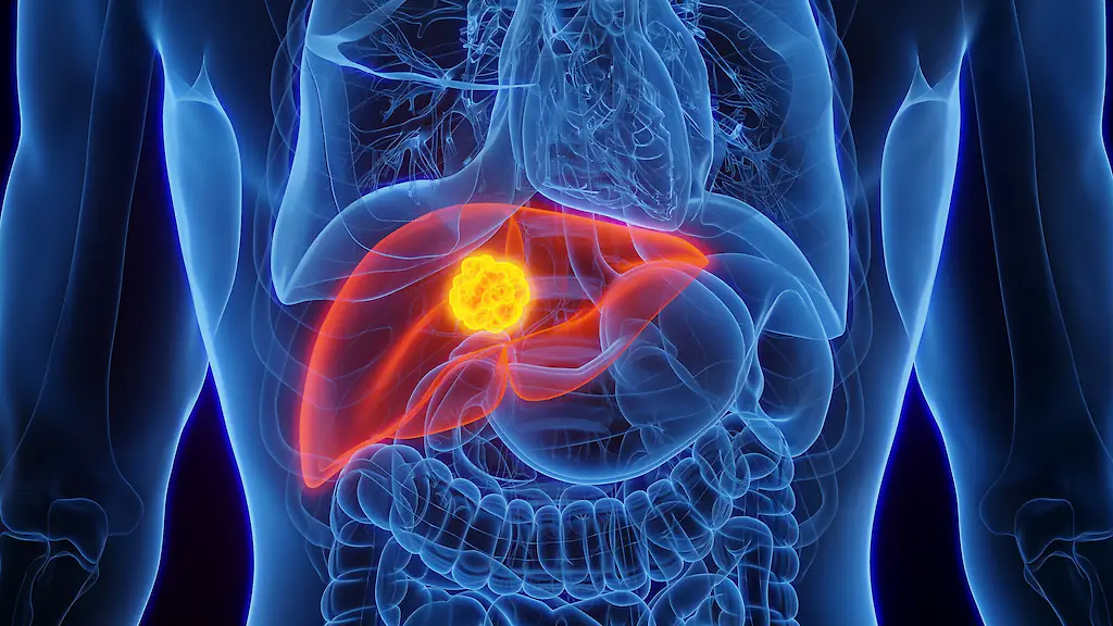Liver cancer is prevalent in those who eat this dish. Credit: Getty Stock Images