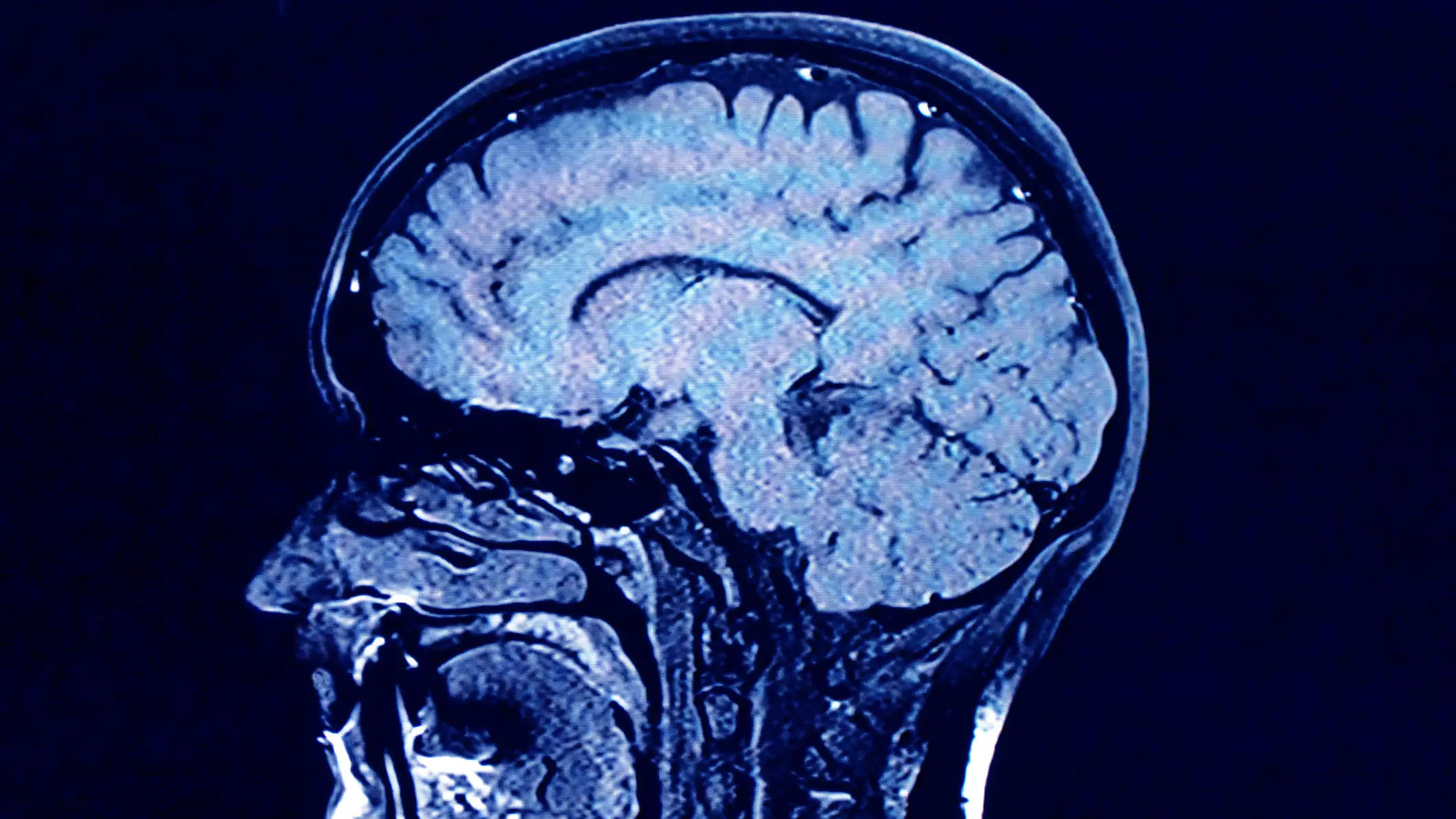 Brain scan