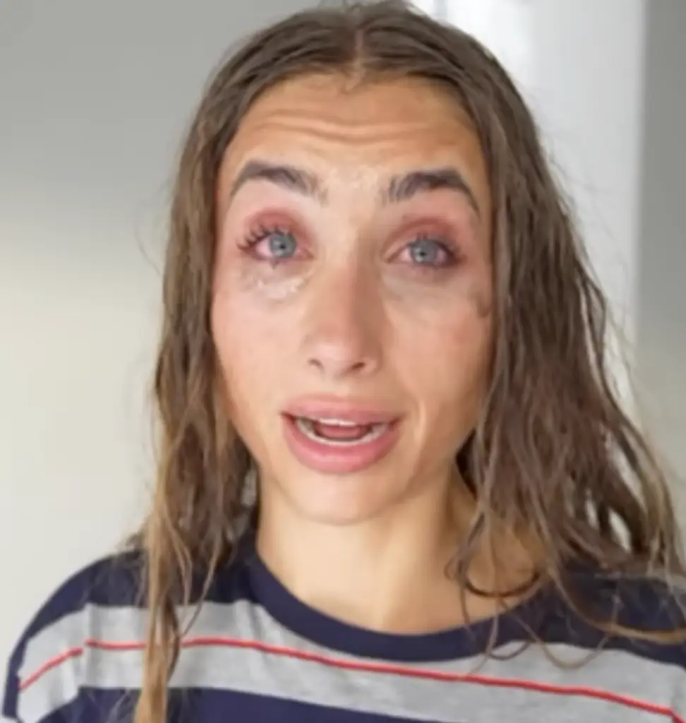 Phillips claims her eyes were destroyed by Brady. Credit: TikTok / Lily Phillips 