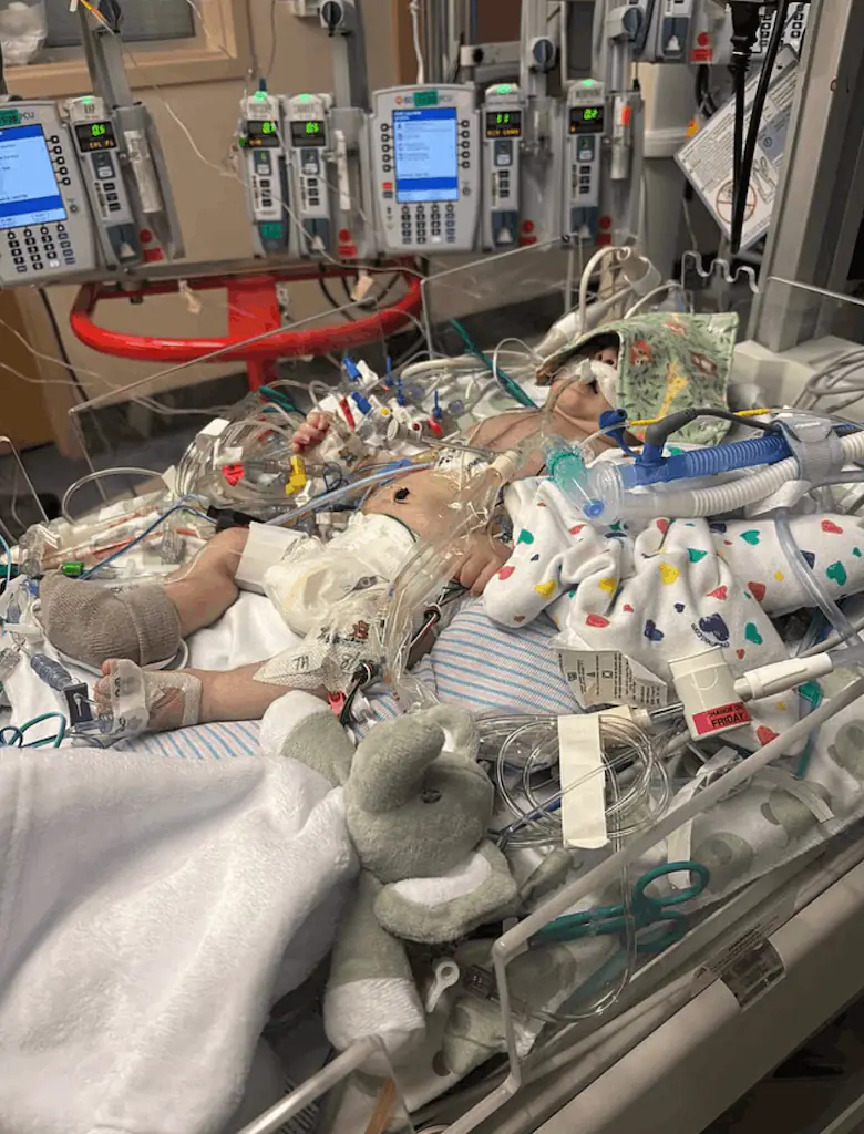 The baby is being kept alive with tubes, wires and breathing equipment following major heart surgery. Credit: GoFundMe
