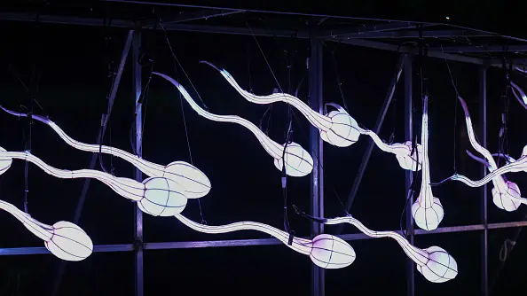 Sperm