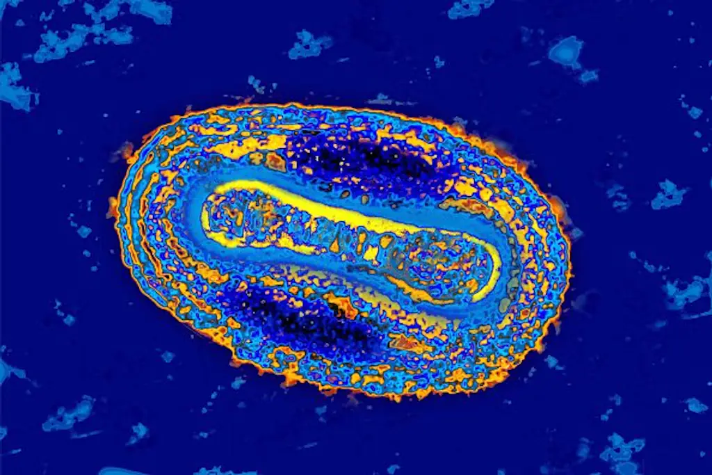 A woman has reportedly died from the 'plague' following a breakage at a laboratory last week. Credit: BSIP/UIG Via Getty Images